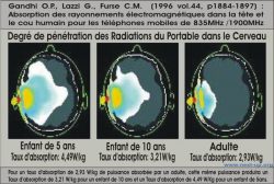 Degre de penetration des radiations portable dans le cerveau